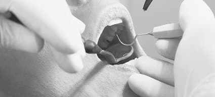 오랜 경험으로 축적된
다양한 수술 케이스